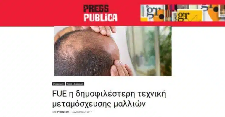 Il metodo Follicular Unit Extraction (FUE) per il trapianto di capelli image