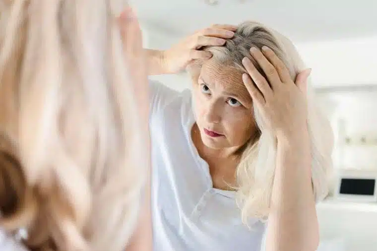 Perte de cheveux chez la femme et ménopause