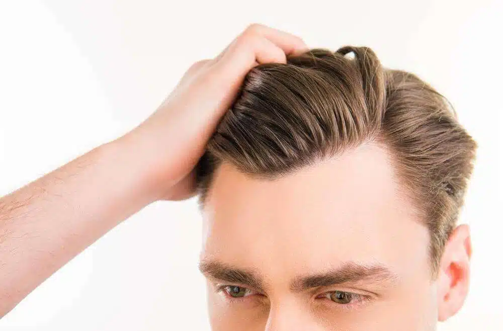 Are Hair Transplant Results Permanent? What You Need to Know