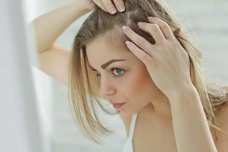 Types of female hair loss image