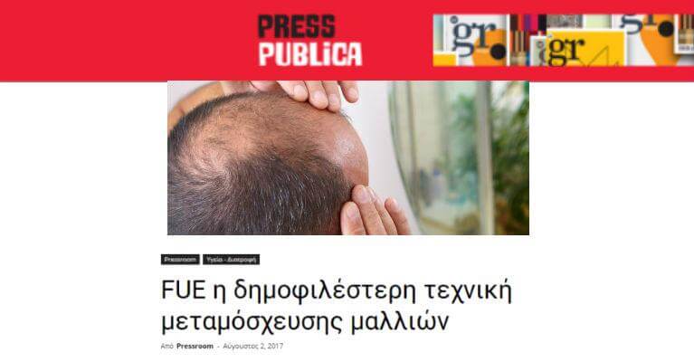 FUE η δημοφιλέστερη τεχνική μεταμόσχευσης μαλλιών, στο presspublica.gr
