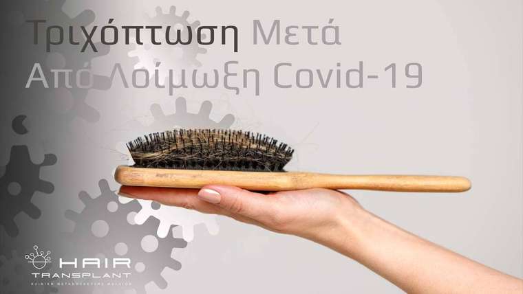 Title Hair loss after Covid-19 infection