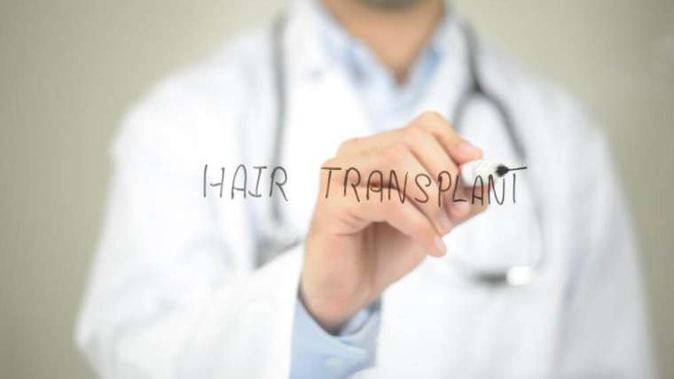 The basic principles of hair transplants