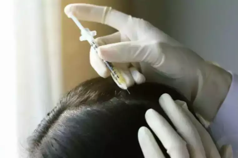 'Caduta dei capelli: Fenomeno stagionale o qualcosa di più serio? Consigli utili per affrontarla con il trattamento PRP' featured image