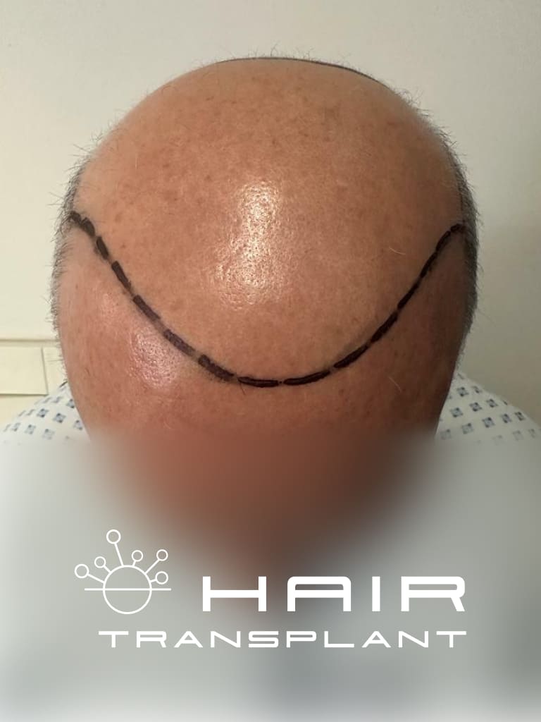 Male 29