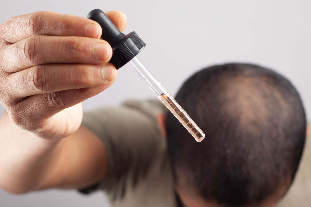 minoxidili-hairtransplant-clinic