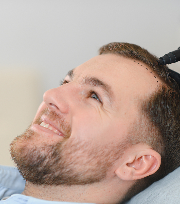 hairtransplant man on the chair