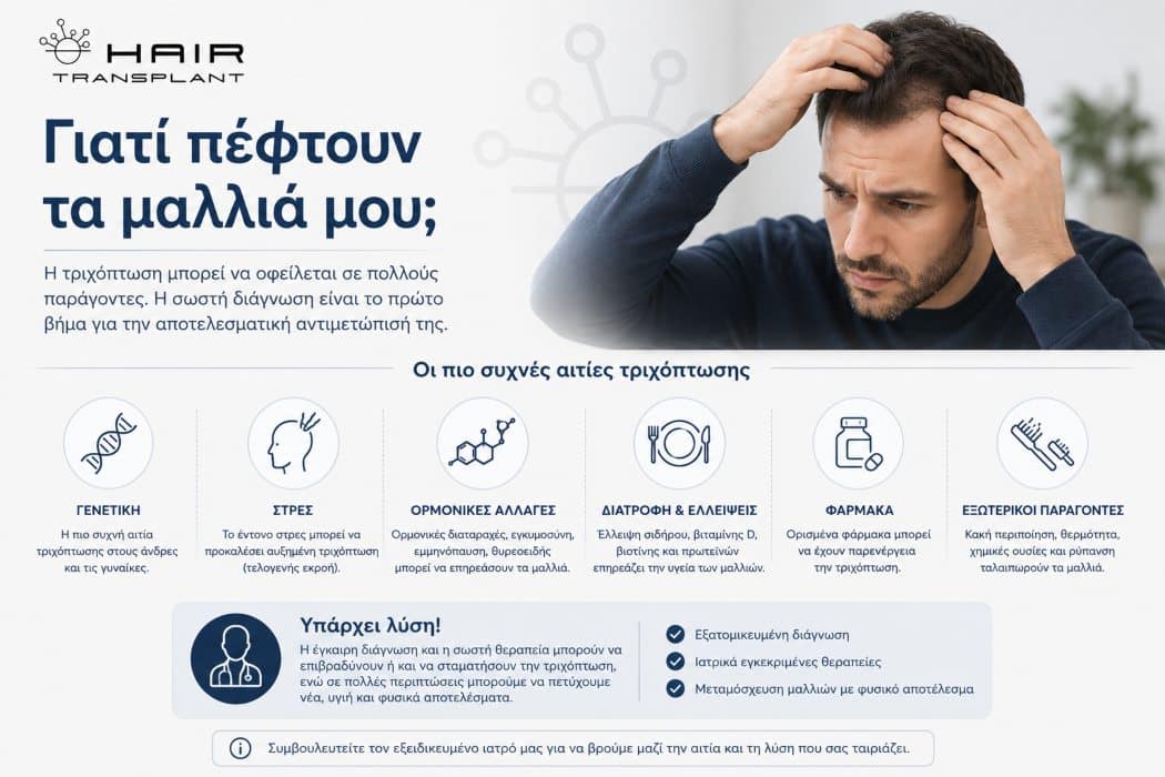 'Γιατί Πέφτουν τα Μαλλιά μου; Οι Συχνότερες Αιτίες' featured image