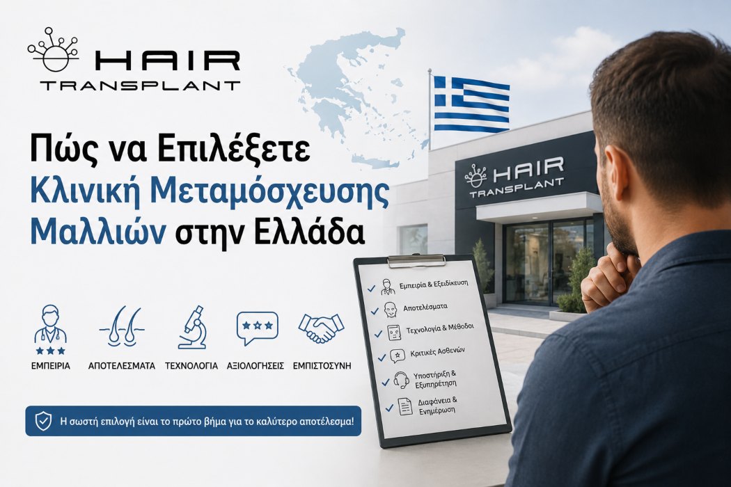 Ιατρός πραγματοποιεί μεταμόσχευση μαλλιών σε εξειδικευμένη κλινική στην Ελλάδα