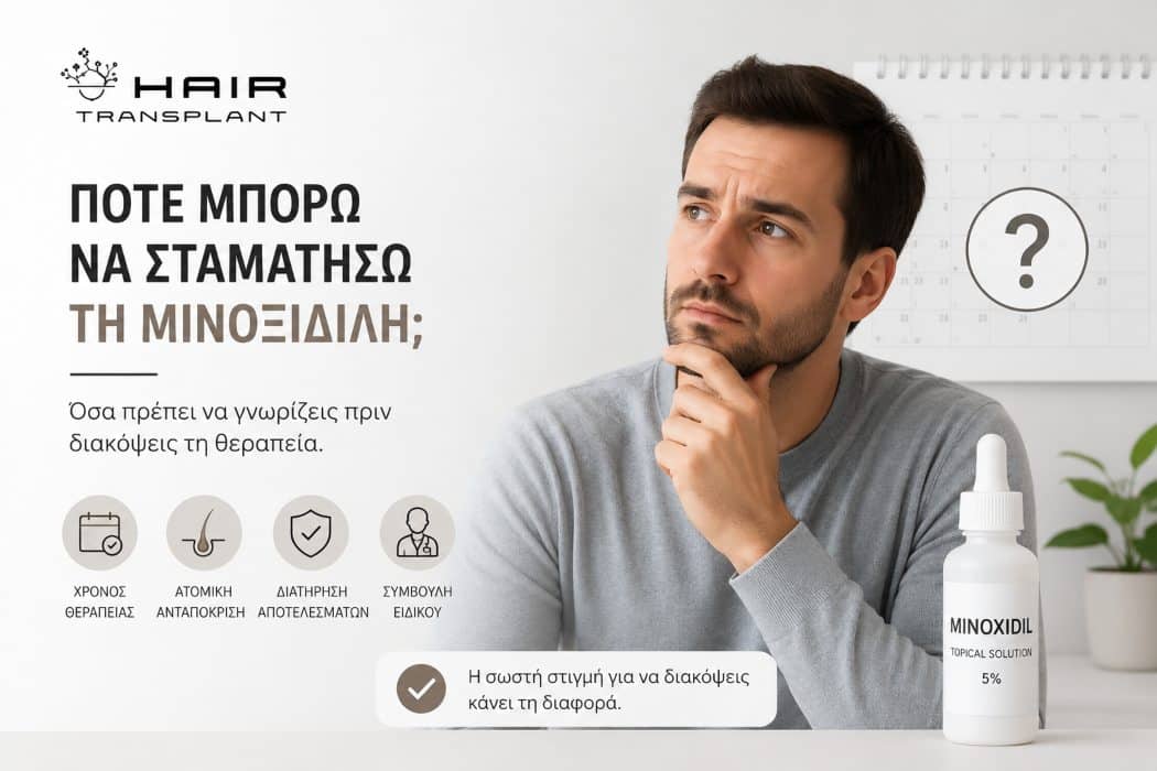 'Πότε Μπορώ να Σταματήσω τη Μινοξιδίλη;' featured image