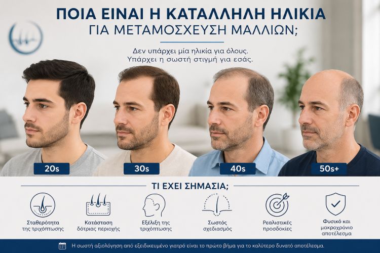 Ποια είναι η κατάλληλη ηλικία για μεταμόσχευση μαλλιών